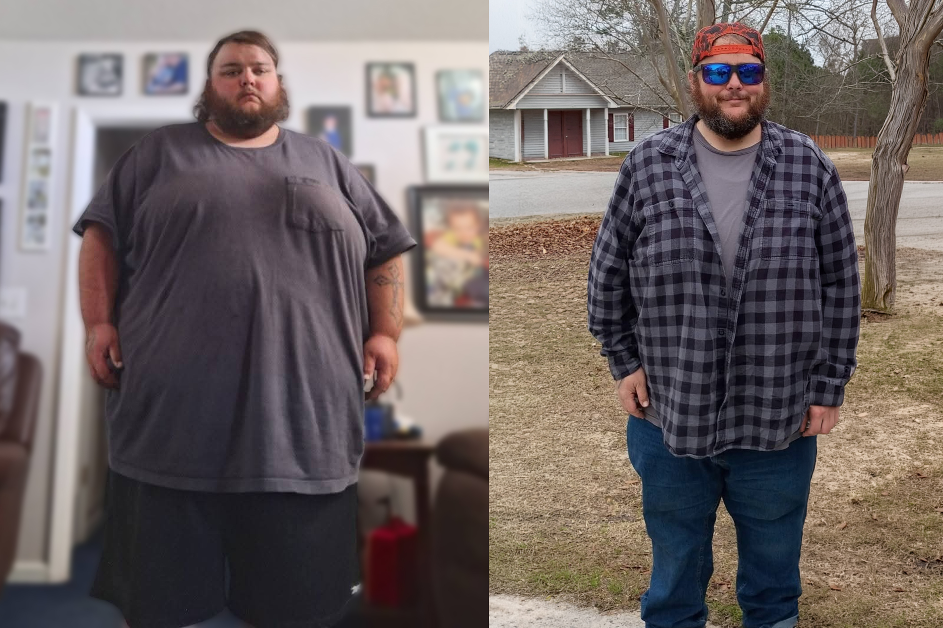 Kendall Varn before and after losing nearly 200 pounds