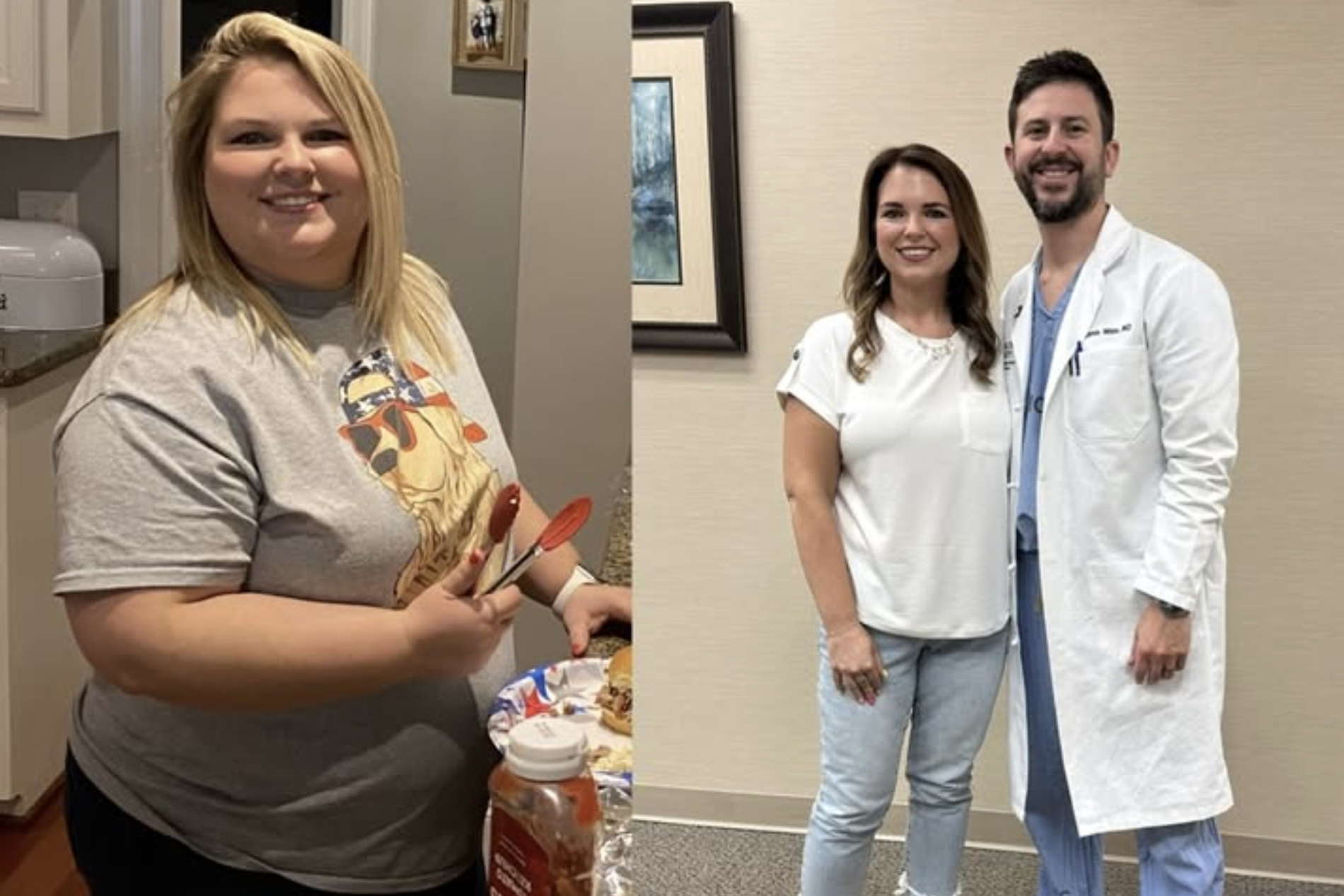 Photos of Meredith Mobley before and after weight loss surgery
