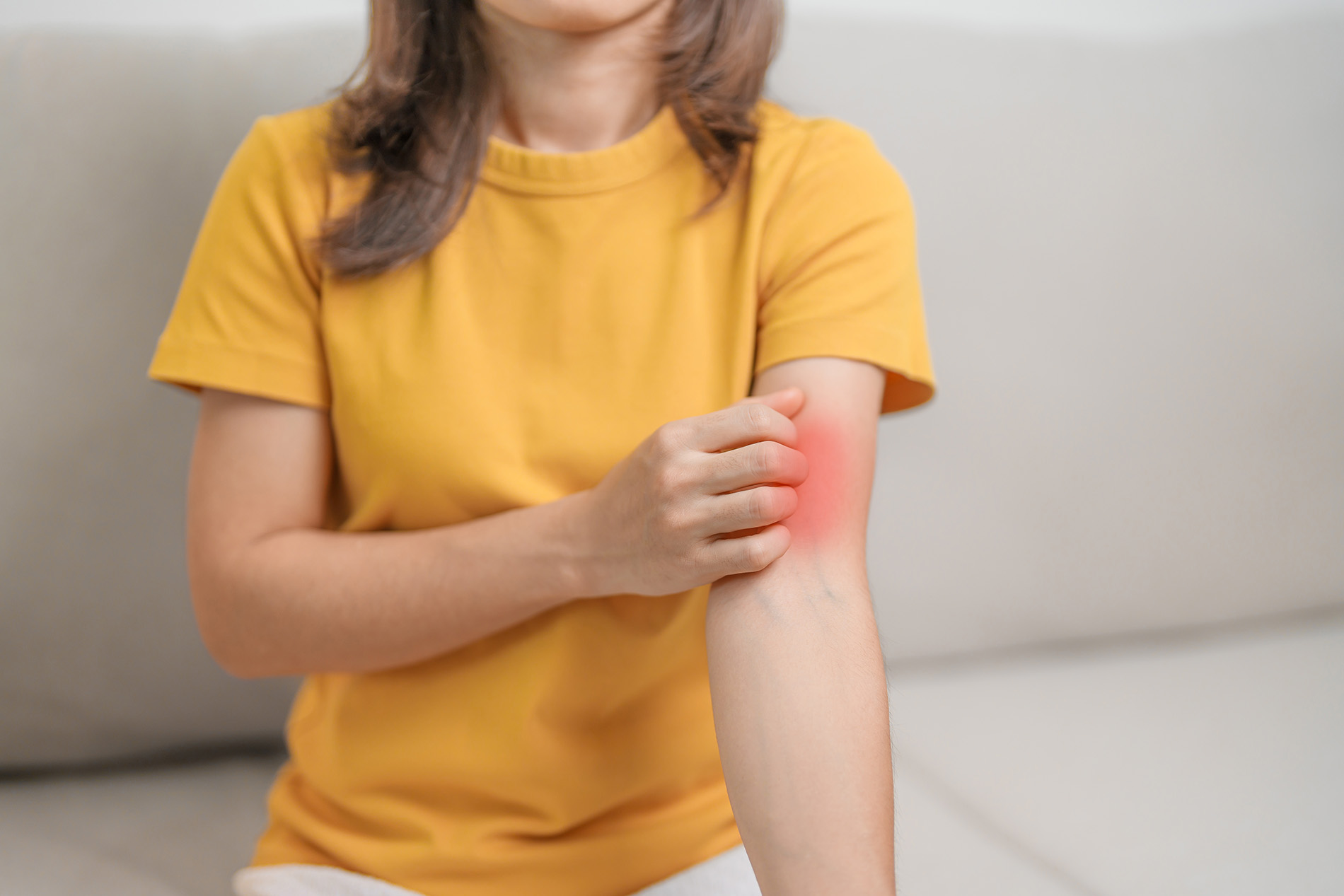 Woman scratching red rash on her arm
