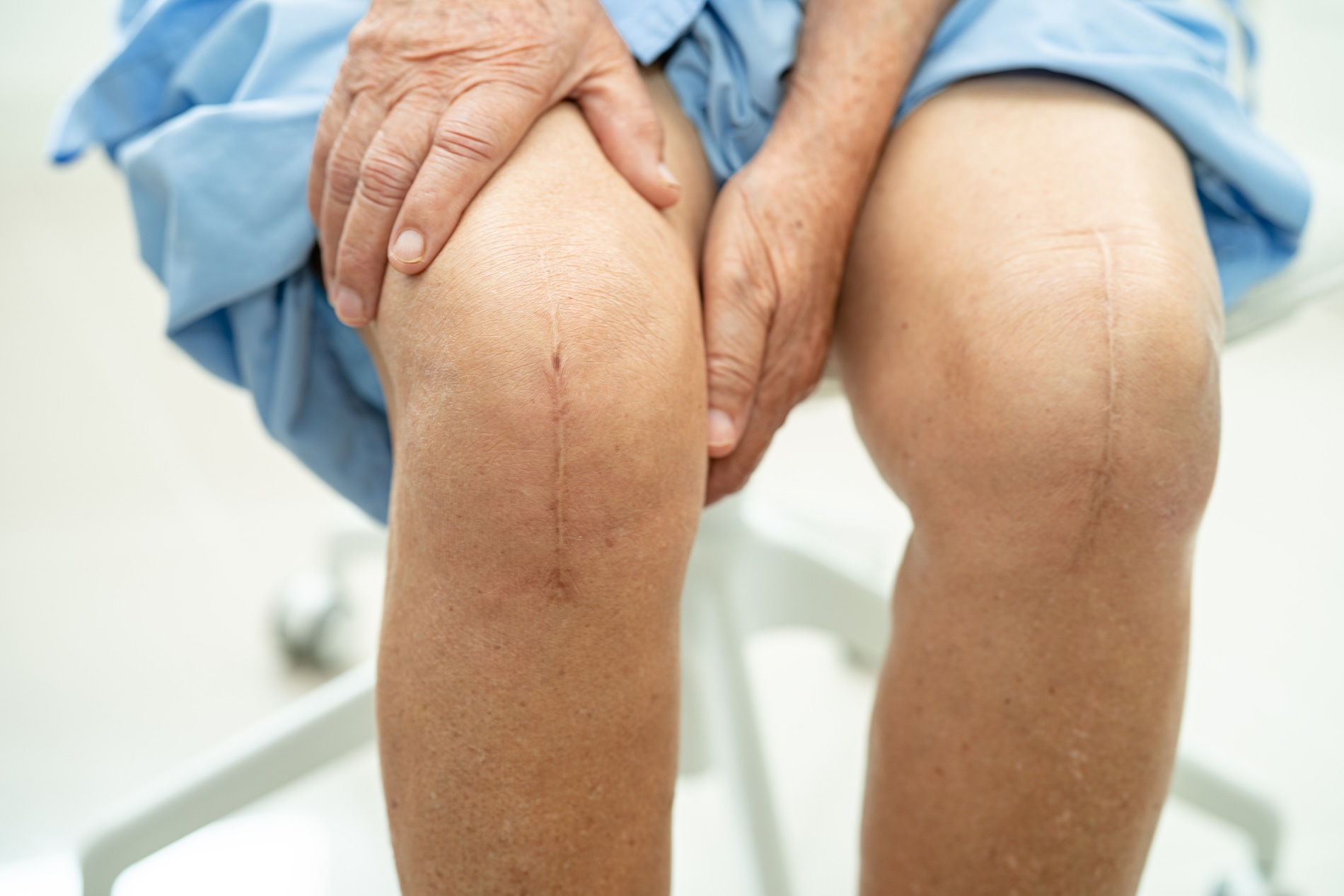 Male patient sitting on medical exam table with surgical scars on his knees